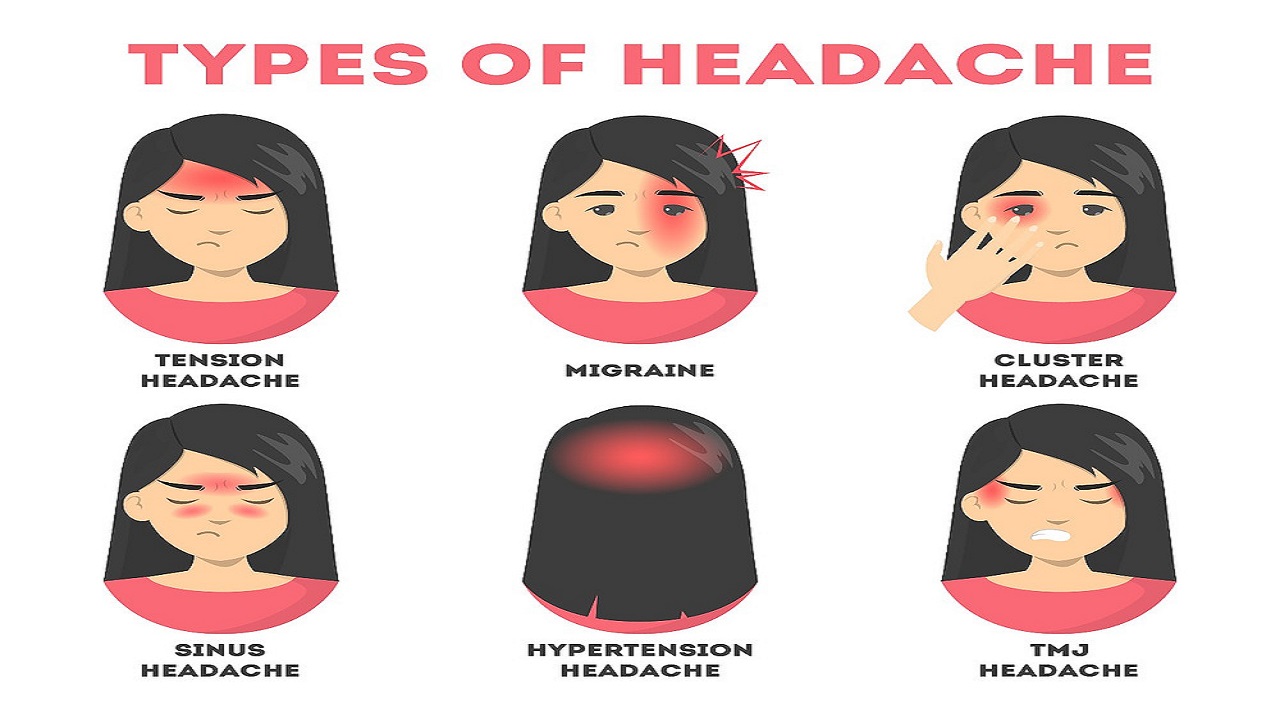 อาการปวดหัว